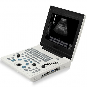 IMGX-60 Full Digital Ultrasound Scanner