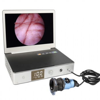 Tinyview 1000s endoscope camera system