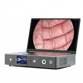 Linkview2200 endoscope camera system