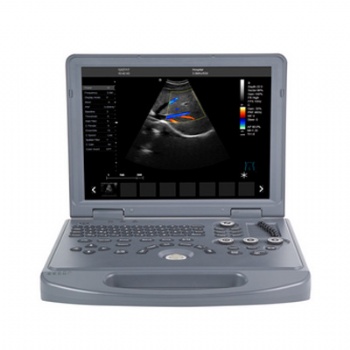 Laptop Color Doppler Ultrasound System